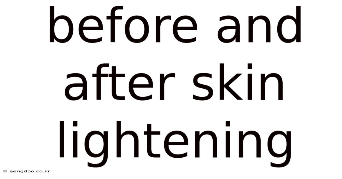 Before And After Skin Lightening
