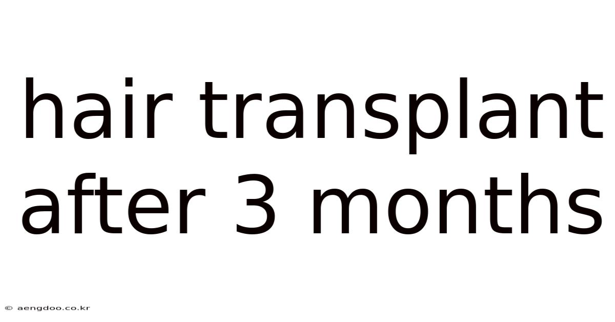 Hair Transplant After 3 Months