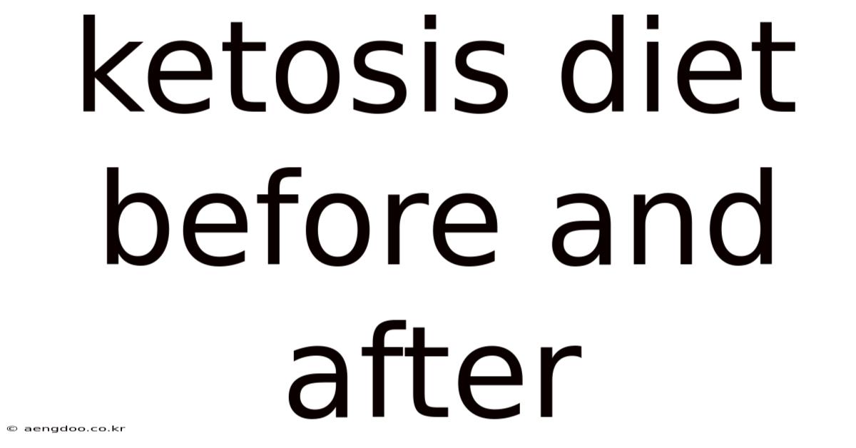 Ketosis Diet Before And After
