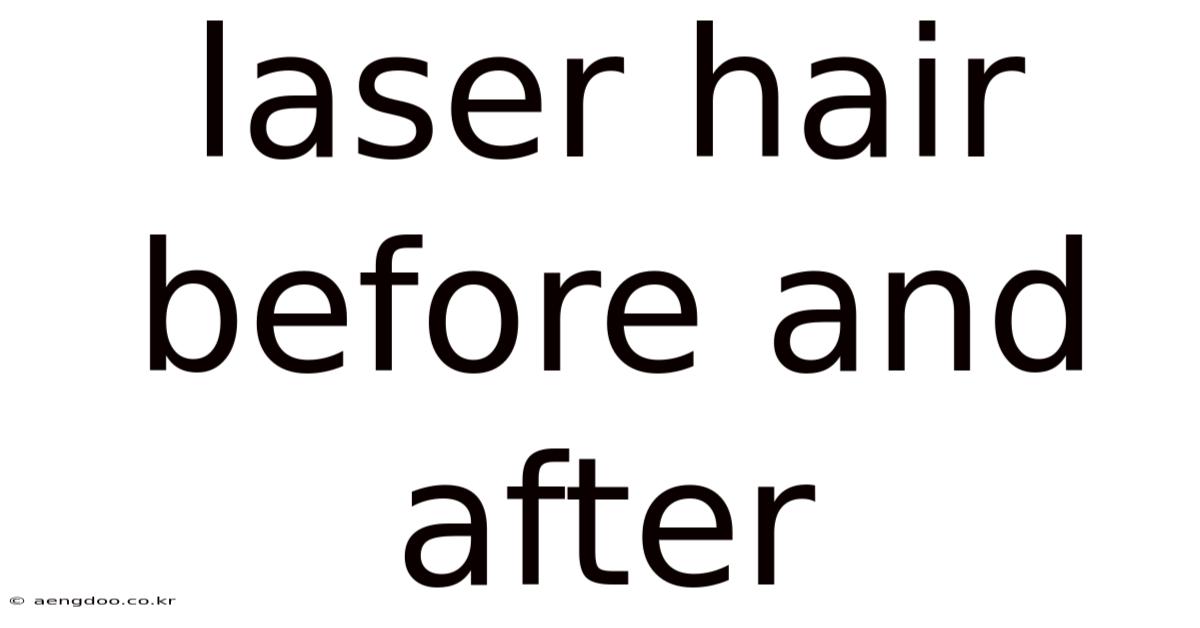Laser Hair Before And After