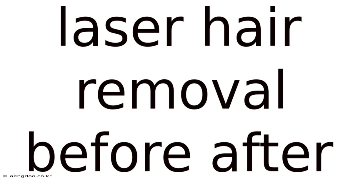 Laser Hair Removal Before After