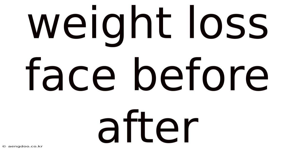 Weight Loss Face Before After